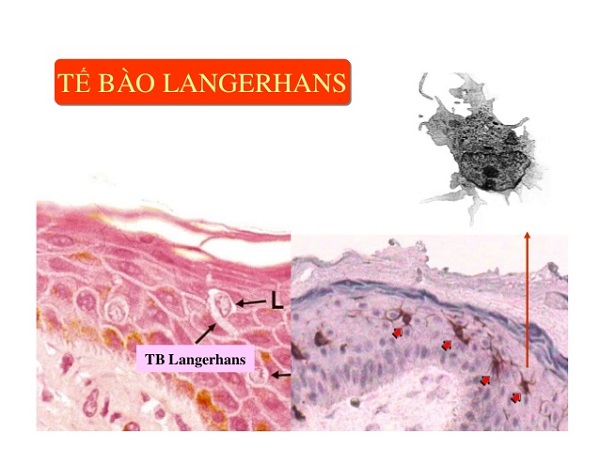 tế bào langerhans là gì và hình ảnh minh họa