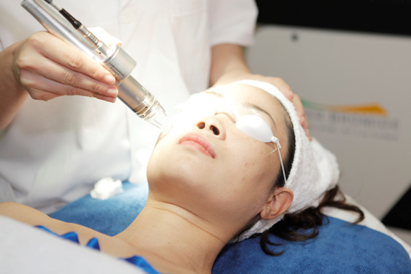 điều trị nám da mặt với phương pháp trị nám bằng laser